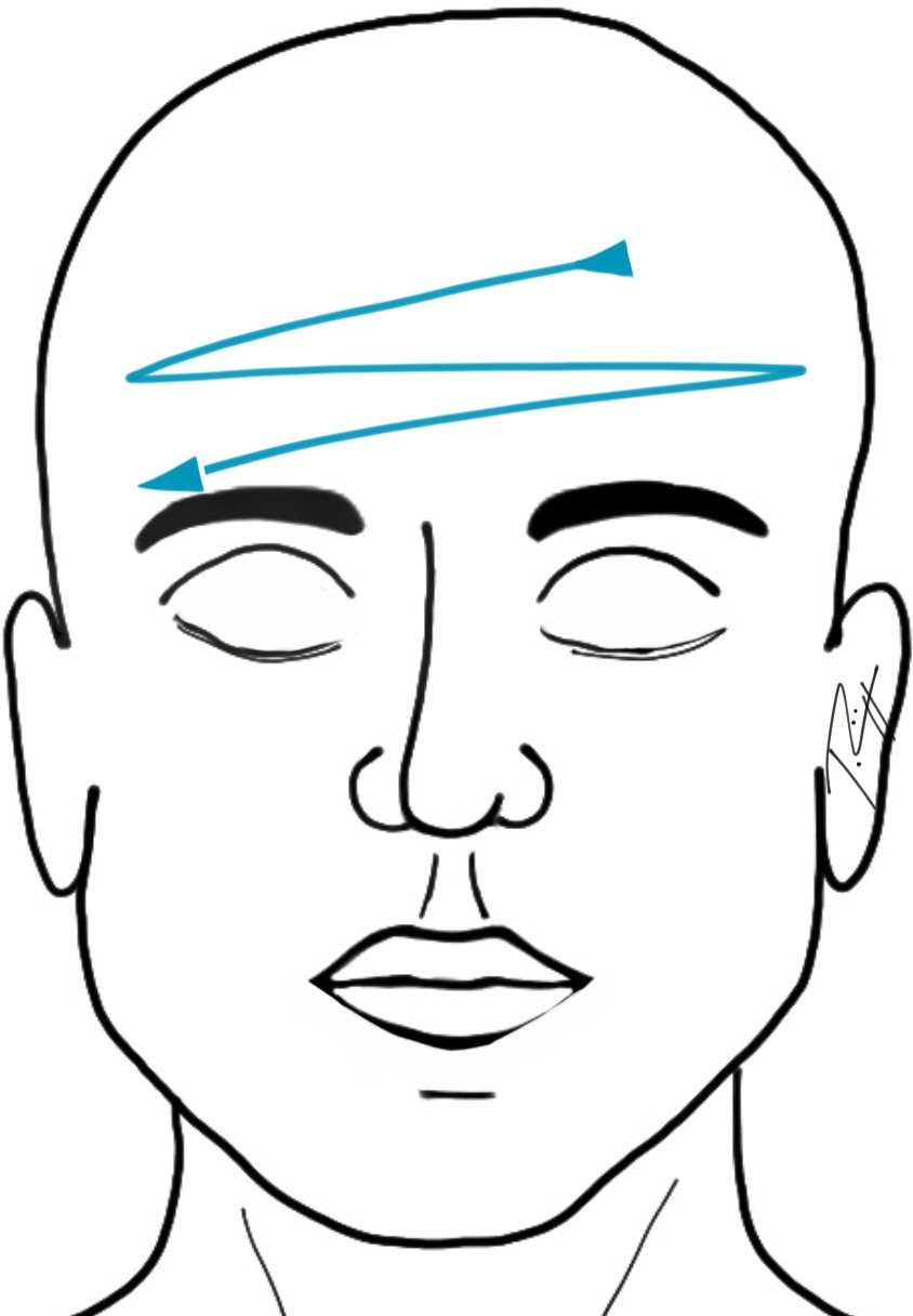Affusion froide du visage technique - Image: J. Rüegger