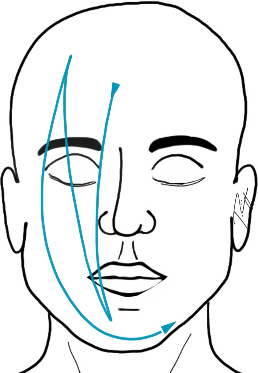 Affusion froide du visage technique - Image: J. Rüegger